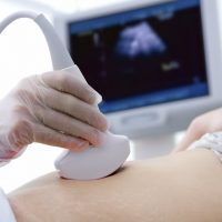 sonogram